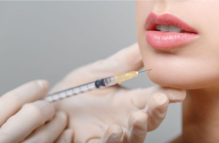 Lip Filler Before and After